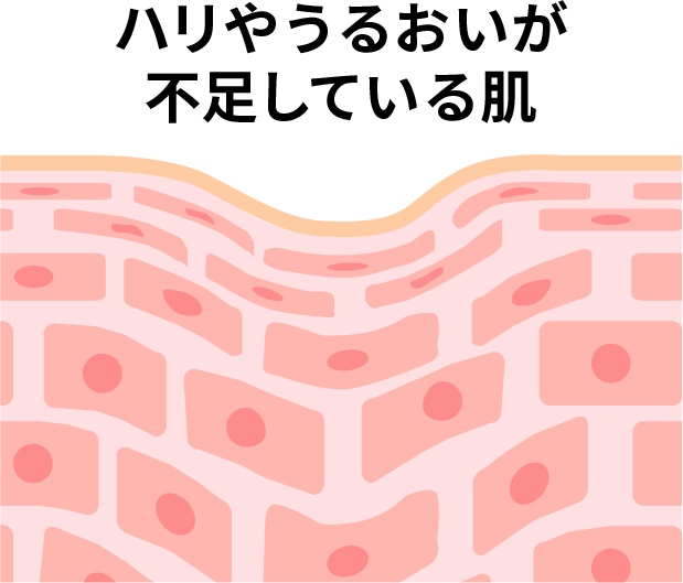 ハリやうるおいが不足している肌